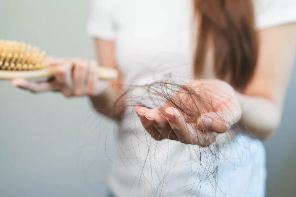 hair loss treatment Singapore.