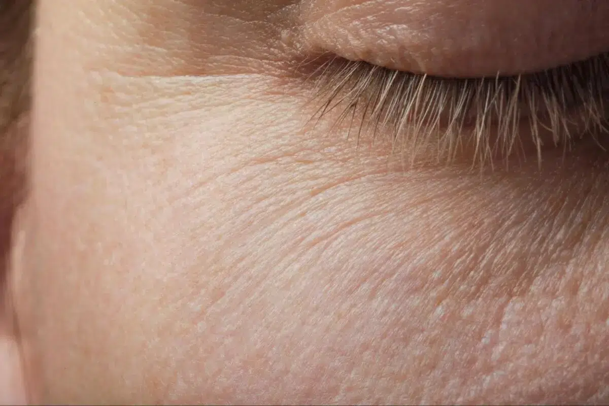 Close-up of mature skin around the eye area showing fine lines and skin texture changes associated with early sagging skin and collagen loss